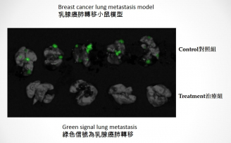 The green signal in the upper part of the photo shows the lung metastasis in breast cancer mouse models in control group, while the lower part of the photo shows that there is no lung metastasis when breast cancer mouse models in treatment group were treated with YB1, indicating that cancer metastasis was completely inhibited with YB1.